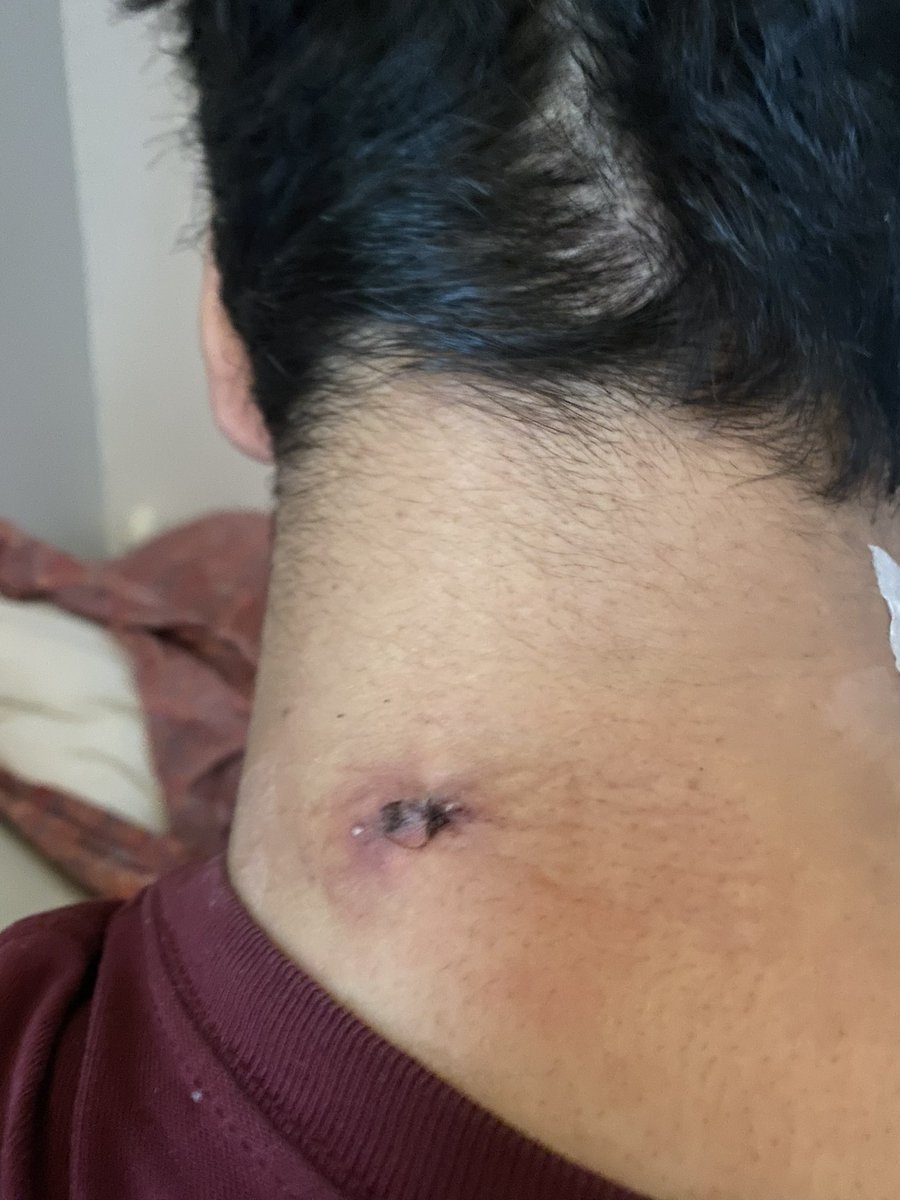 gawk's tweet image. A hair in any direction and I would’ve been dead. I’m a happy to be alive.