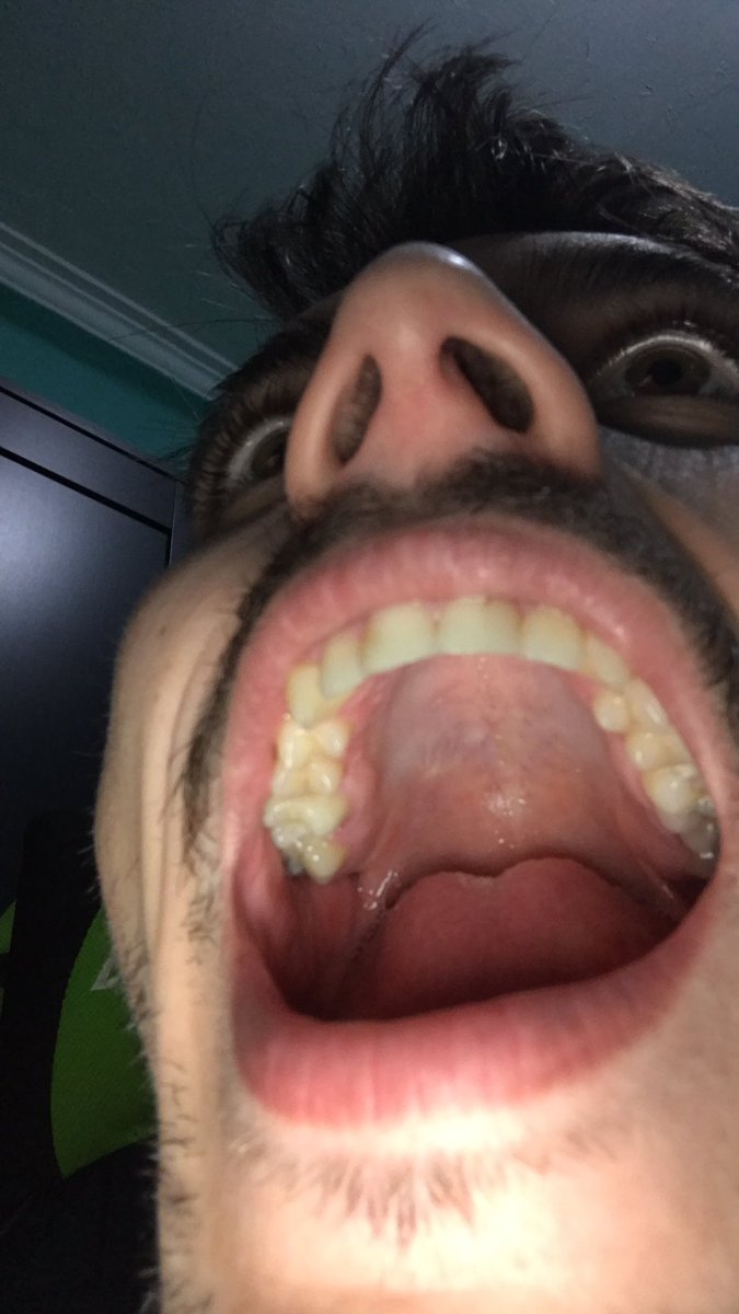 Zyzzar420's tweet image. Arreglad apex #fixapex #brokenmoonfreeze