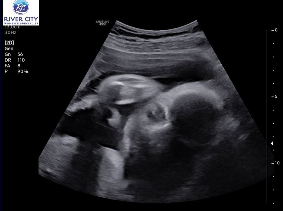 isabellag0502's tweet photo. 30 weeks🤍 #10weeksleft https://t.co/zfFn6o5fgK
