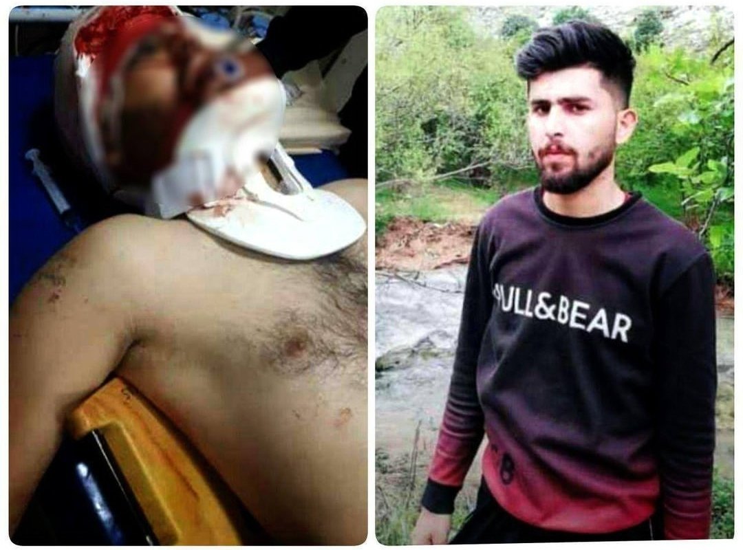 برای #حسین_لرستانی ۲۵ ساله یکی از غیورهای #لر ۹۸ که با نامردی سرشو نشونه گرفتن، این روزا روزای انتقام بچه های آبان ۹۸عه!
#آبان #مهسا_امینی #نیکا_شاکرمی