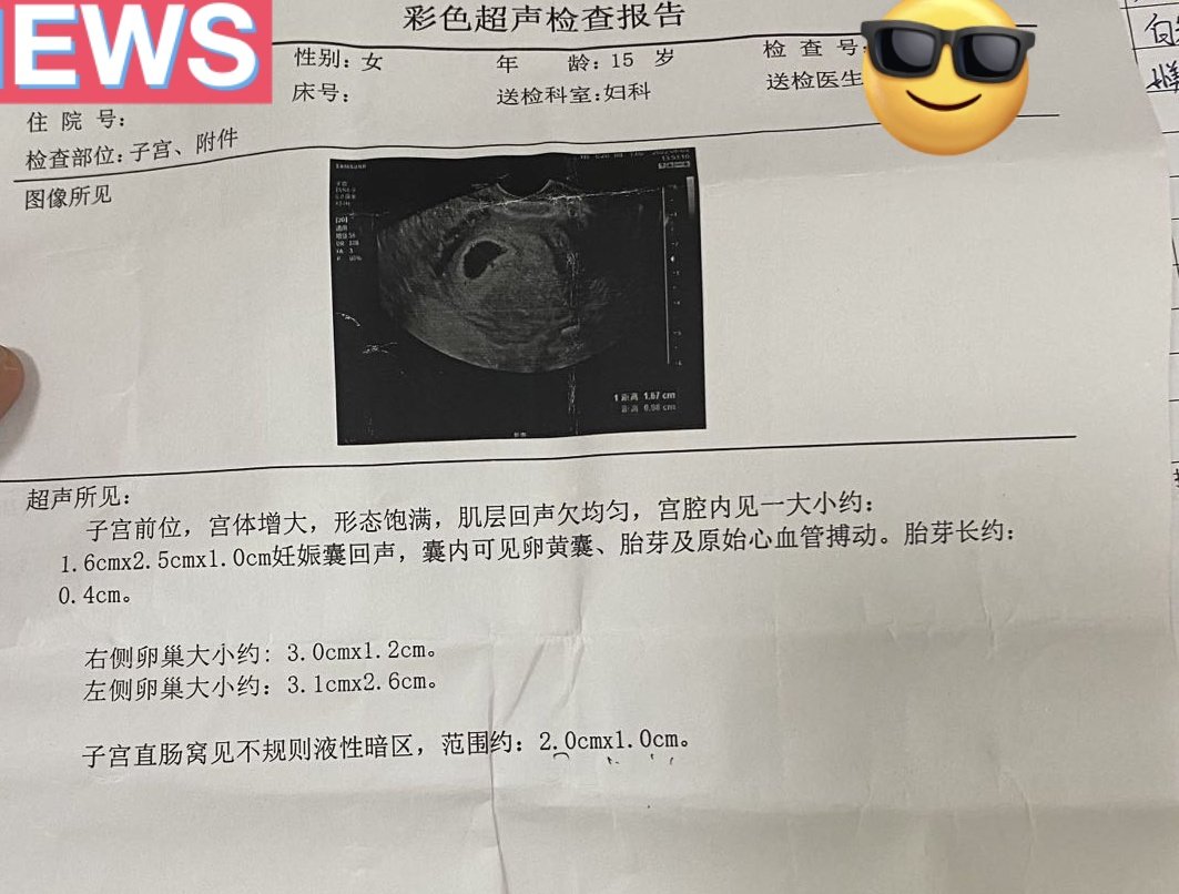 SS_9800's tweet photo. 大学生不香，06年的小女友才真香，斯斯文文青青纯纯，那小穴我舔着都觉得香甜
#06年 #学生妹 https://t.co/TkxGHAxWBd