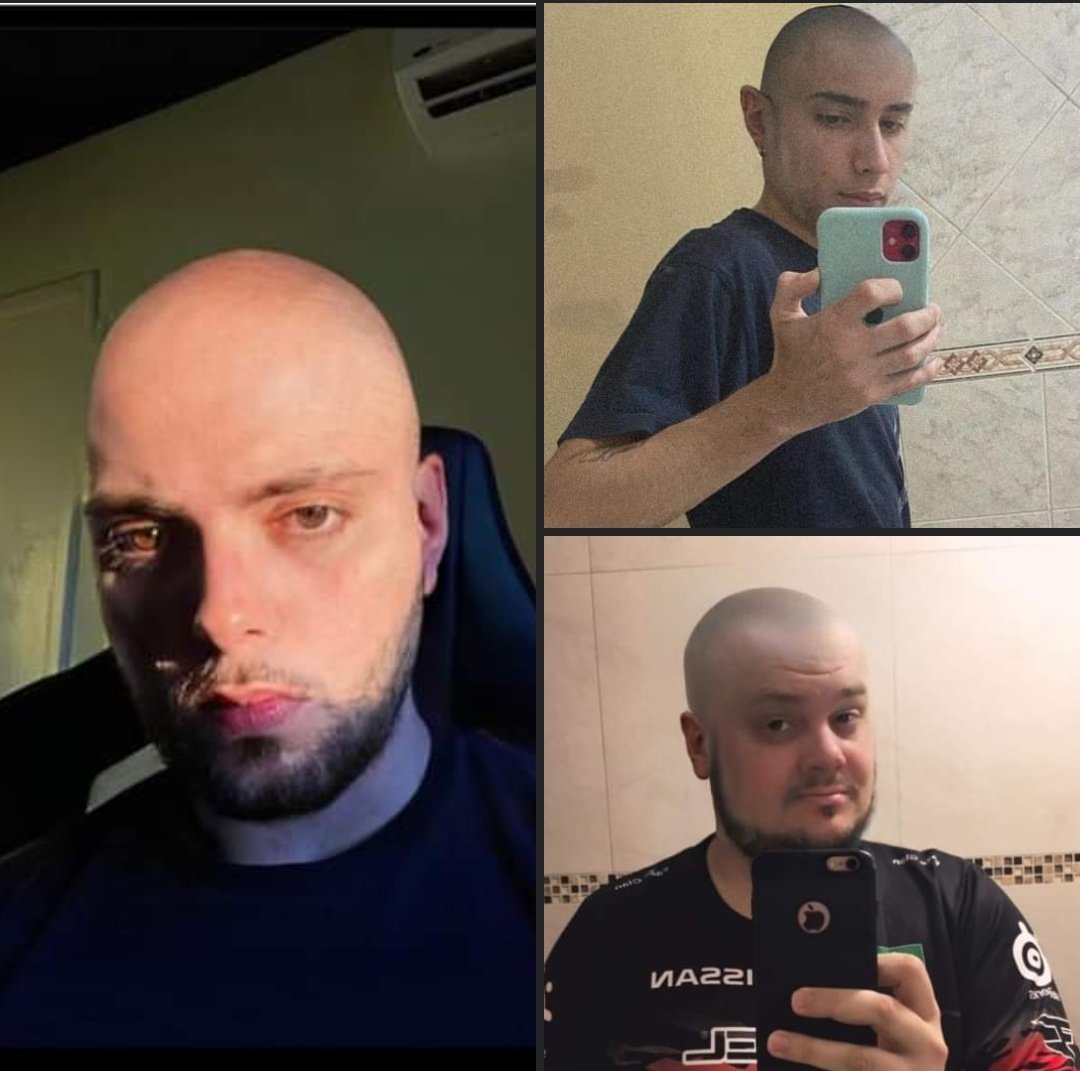 NinextFunkeiroo's tweet photo. @ninexTT Os 100Cabelo 🥵🤌🏼 https://t.co/Pkd6X40DxI