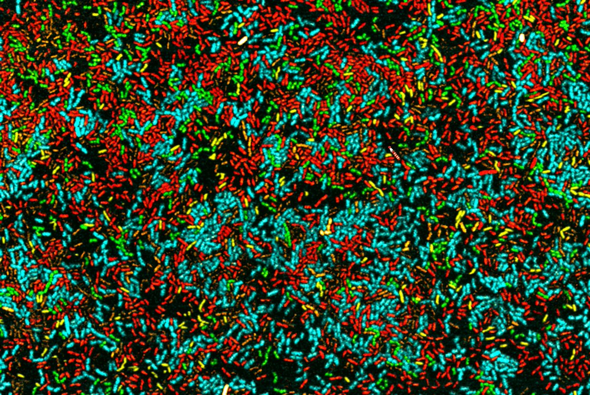 Bill Söderström (@billsoderstrom) on Twitter photo Gloomy Monday morning? Cheer up, I made a "Where's Wally: Bacterial edition" just for you. You're welcome. <a href="/AIMI_UTS/">Australian Institute for Microbiology & Infection</a> <a href="/UTS_Science/">UTS Science</a> <a href="/UTSResearch/">UTS Research</a> Gloomy Monday morning? Cheer up, I made a "Where's Wally: Bacterial edition" just for you. You're welcome. <a href="/AIMI_UTS/">Australian Institute for Microbiology & Infection</a> <a href="/UTS_Science/">UTS Science</a> <a href="/UTSResearch/">UTS Research</a>
