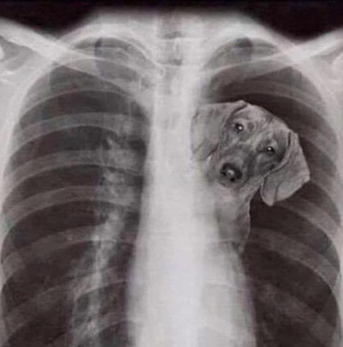 CliettCody's tweet photo. @TylerCole20 @bshields0244 @KarstenG6 @CalHSFootball X-Ray of Karsten Gullette after the Clarksdale game #Gotthatdoginhim https://t.co/ovIaDNByt5