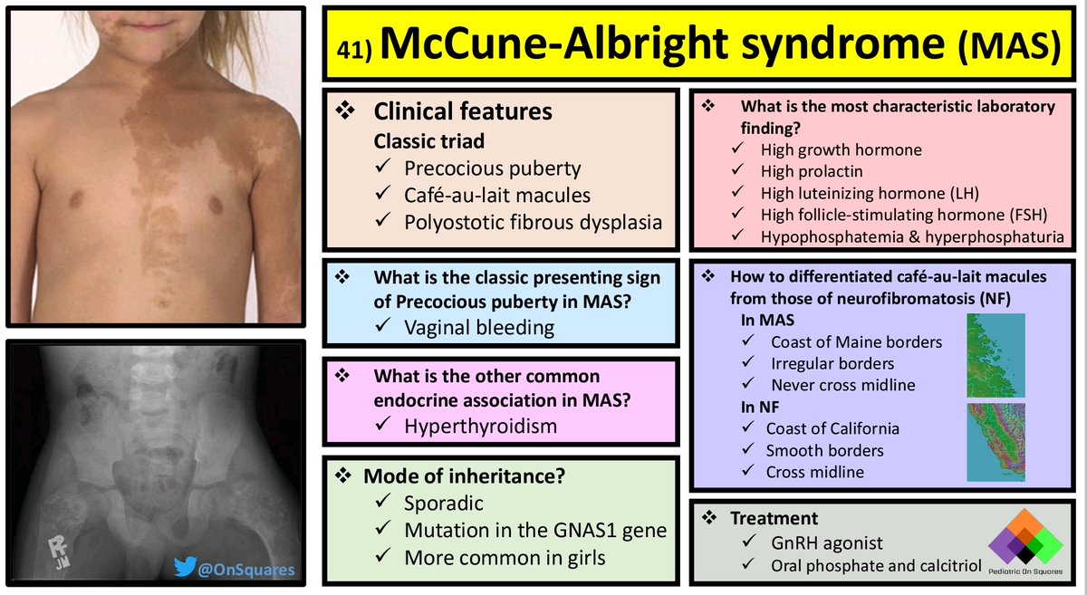 Healthnotes.jpg on twitter: "rt @medicolearning: mccune-albright