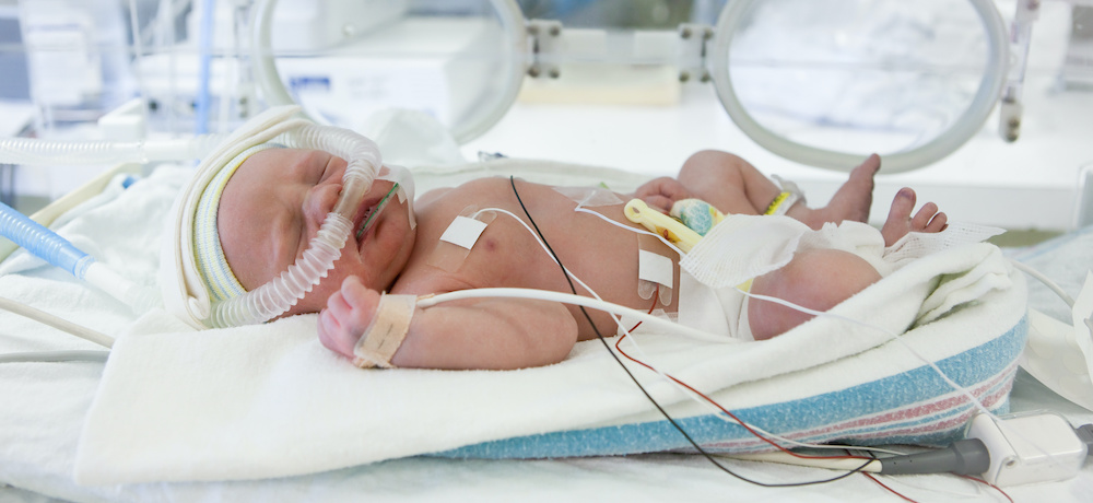 Clinical AI Platform for severe respiratory disease receives CE-IVD mark

med-technews.com/news/Medtech-D…

<a href="/simedx/">SIME Diagnostics</a> 

#medtech #AI #respiratorydisease #diagnostics