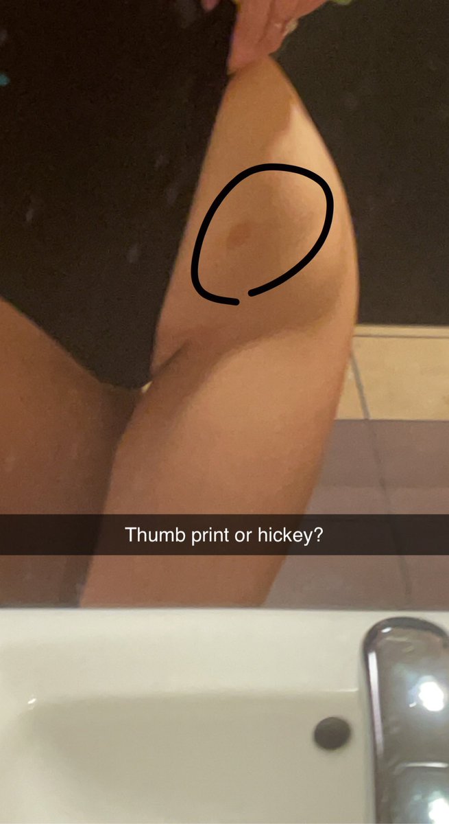 MuchLove_Bailey's tweet photo. I love finding marks from the night before https://t.co/h8HqgKZ40r