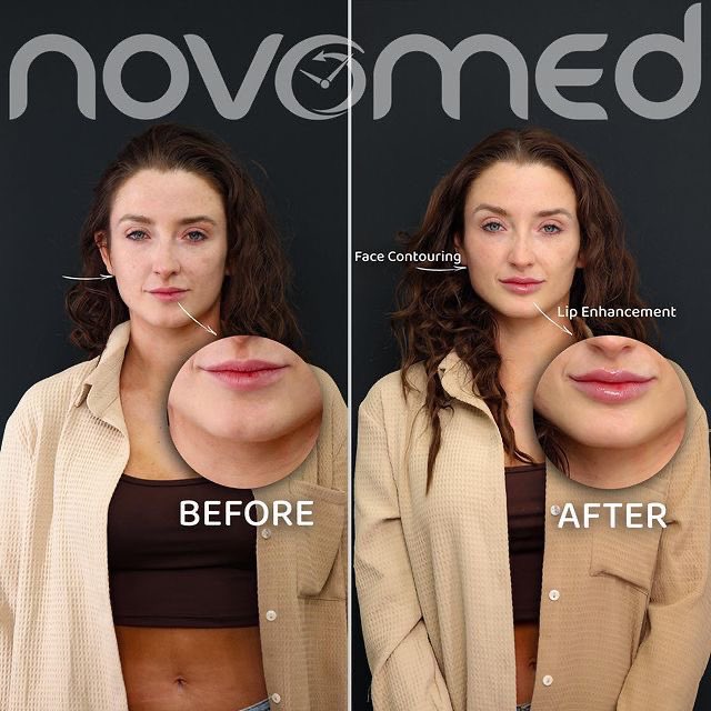Novomed tweet media