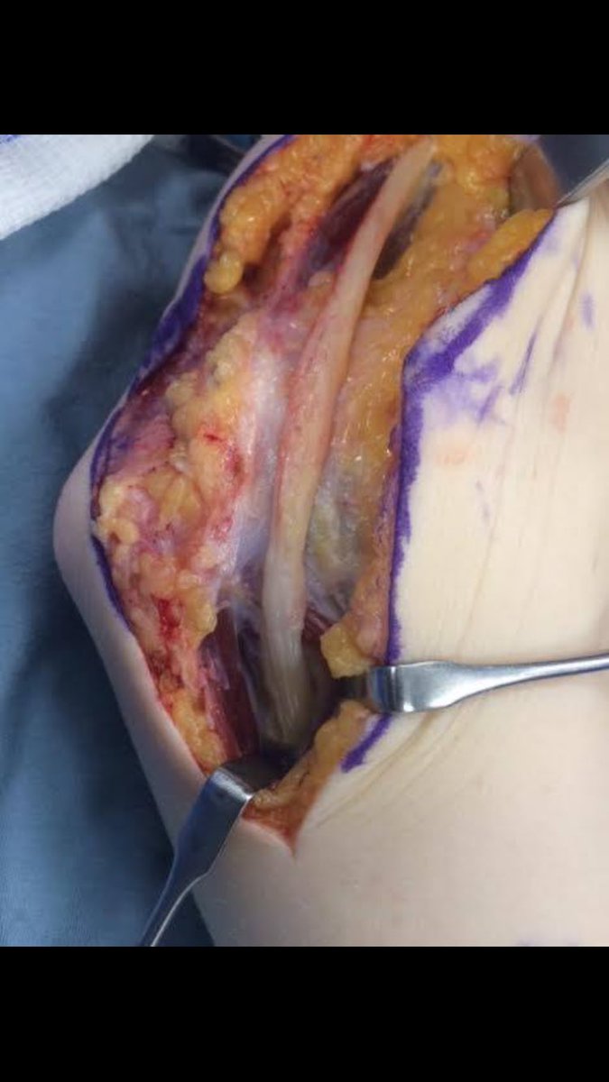 Yelena Bogdan, MD, FACS, FAAOS tweet media