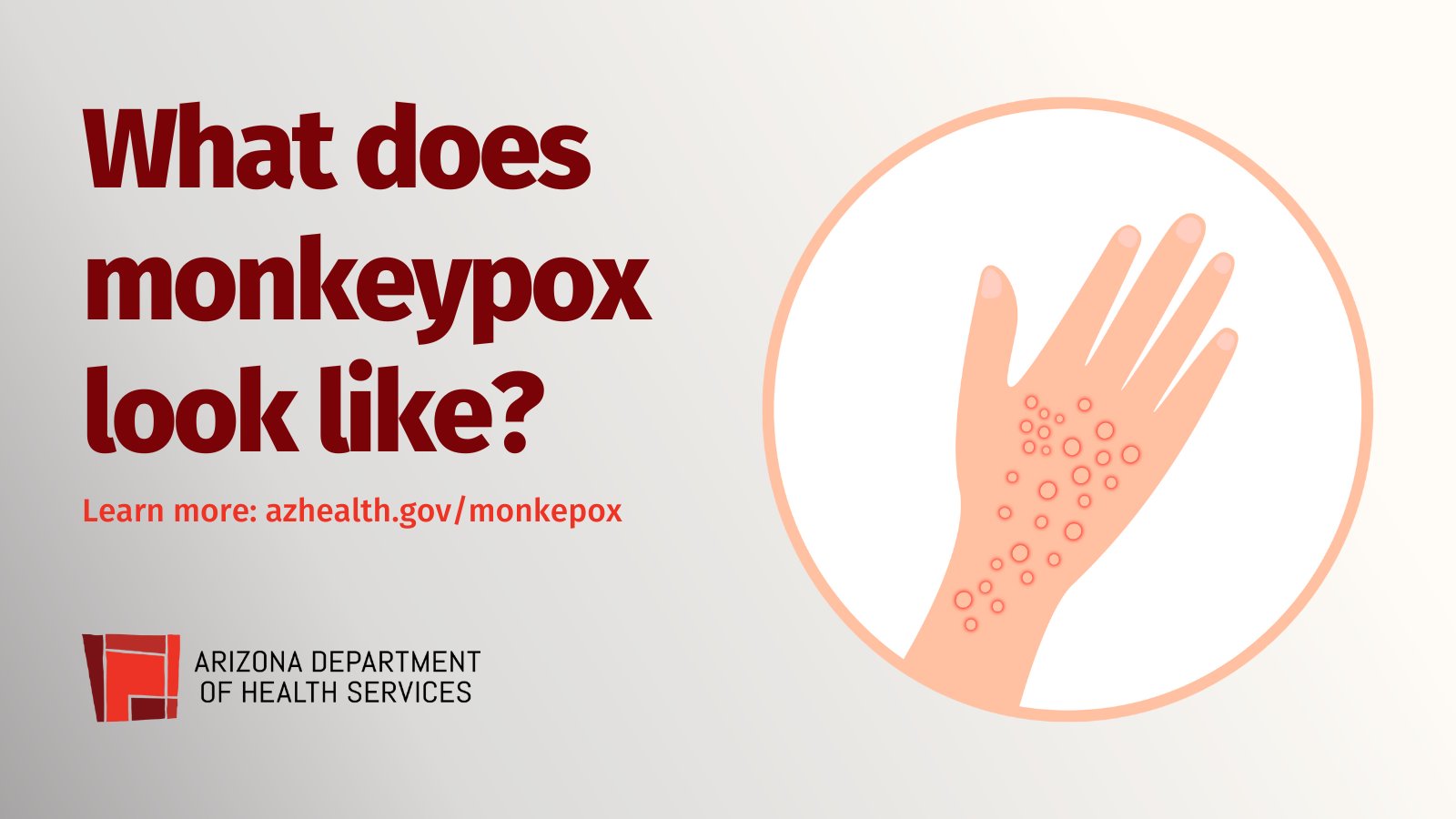 AZ Dept of Health on Twitter "Roughly 6 out of every 100 monkeypox