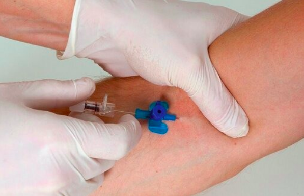 MarcGozlan's tweet photo. Le nouveau visage des complications du diabète. À lire sur le blog 'Le #diabète dans tous ses états' https://t.co/umYaMjMKGA https://t.co/6gavS5yzIP