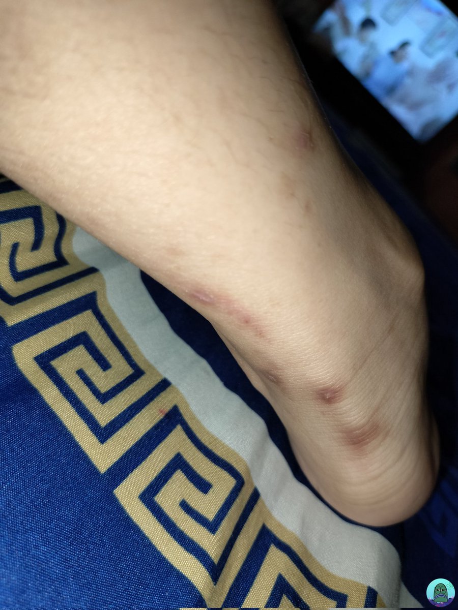 Tanyarl 💚 tweet media