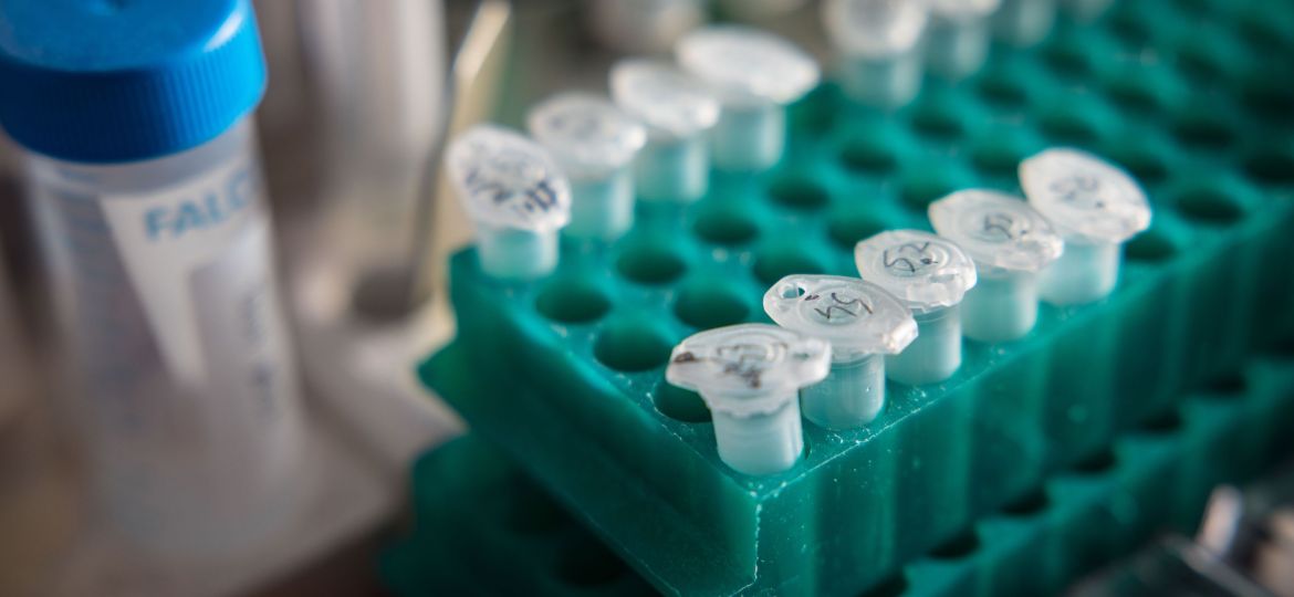 VHIO's tweet photo. 🗞 En un artículo publicado en @NatureMedicine, @AnaVivancosVHIO y @TaberneroJosep explican los resultados de un estudio de cohortes de pacientes con #CPCNP metastásico sometidos a secuenciación del #ctDNA en plasma.

➕ https://t.co/R8mCORHPN6 https://t.co/V0QShxPoJn