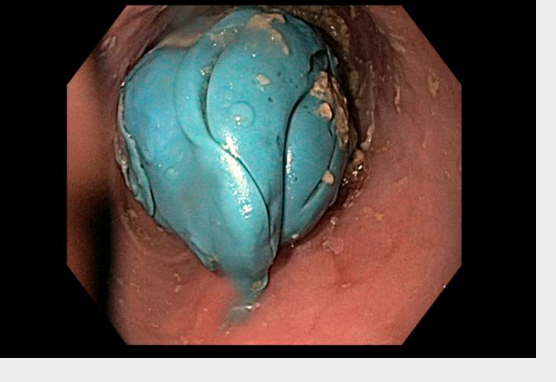 Sultan Mahmood MD FASGE tweet media