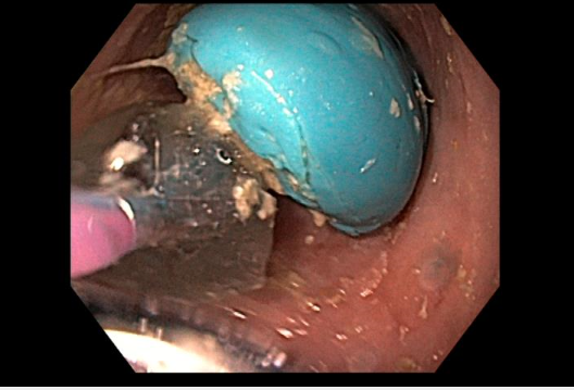 Sultan Mahmood MD FASGE tweet media