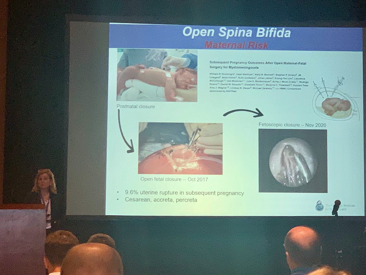 Sandi Lam (@sandi_lam) on Twitter photo <a href="/RobinBowman1911/">Robin Bowman</a> gave a great presentation on fetal neurosurgery, fetoscopic repair of spina bifida at ww.ifmss.org #international #fetal #medicine & #surgery society 40th meeting. Thanks for representing <a href="/ChicagoFetal/">The Chicago Institute for Fetal Health</a> <a href="/Lurieneurosurg/">Lurie Children's Pediatric Neurosurgery</a> = thoughtful innovation + care <a href="/RobinBowman1911/">Robin Bowman</a> gave a great presentation on fetal neurosurgery, fetoscopic repair of spina bifida at ww.ifmss.org #international #fetal #medicine & #surgery society 40th meeting. Thanks for representing <a href="/ChicagoFetal/">The Chicago Institute for Fetal Health</a> <a href="/Lurieneurosurg/">Lurie Children's Pediatric Neurosurgery</a> = thoughtful innovation + care