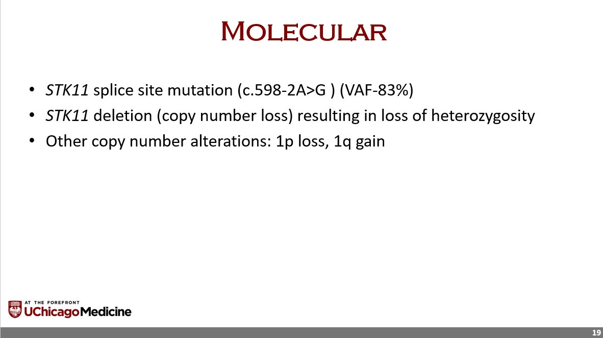 m9goel's tweet photo. Here is the IHC summary, molecular findings, discussion, and the final diagnosis: STK11 adnexal tumor. @UChicagoPath #IRAP22 @ChicagoPathSoc https://t.co/1js8DK6L0C