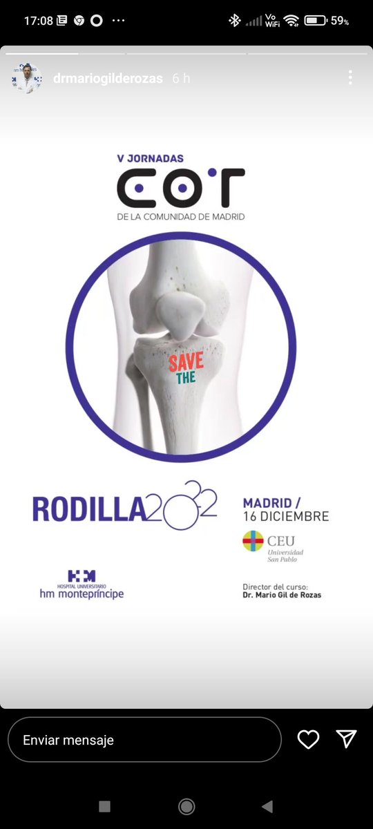 DrCobos_COT's tweet photo. curso imprescindible si te dedicas a la cirugía de rodilla!!
Residentes o cirujanos de rodilla que queráis estar actualizados en este campo, este es vuestro curso!
https://t.co/2ZXuh64lKY https://t.co/Jtxo1K1L8V