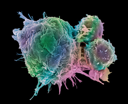 NatureBiotech's tweet photo. In Brief: An @EMA_News committee recommends an allogeneic T cell immunotherapy from Atara Biotherapeutics $ATRA for approval. #Ebvallo would be the first off-the-shelf treatment to receive a green light https://t.co/NZPyIp5Wi9 https://t.co/iNCYoLlHg8 https://t.co/YgBwurMejS