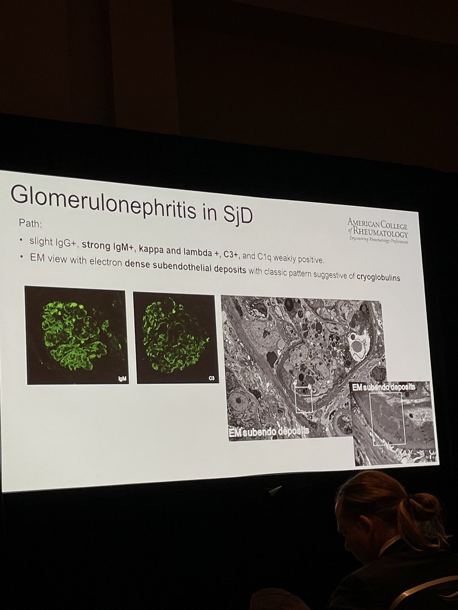 Our rheumatic diseases are systemic diseases; even Sjogren’s Disease. Renal and pulmonary involvement may be present, and more profound than sicca symptoms. Don’t forget to screen for these in SjD! #ACR22 #RheumTwitter