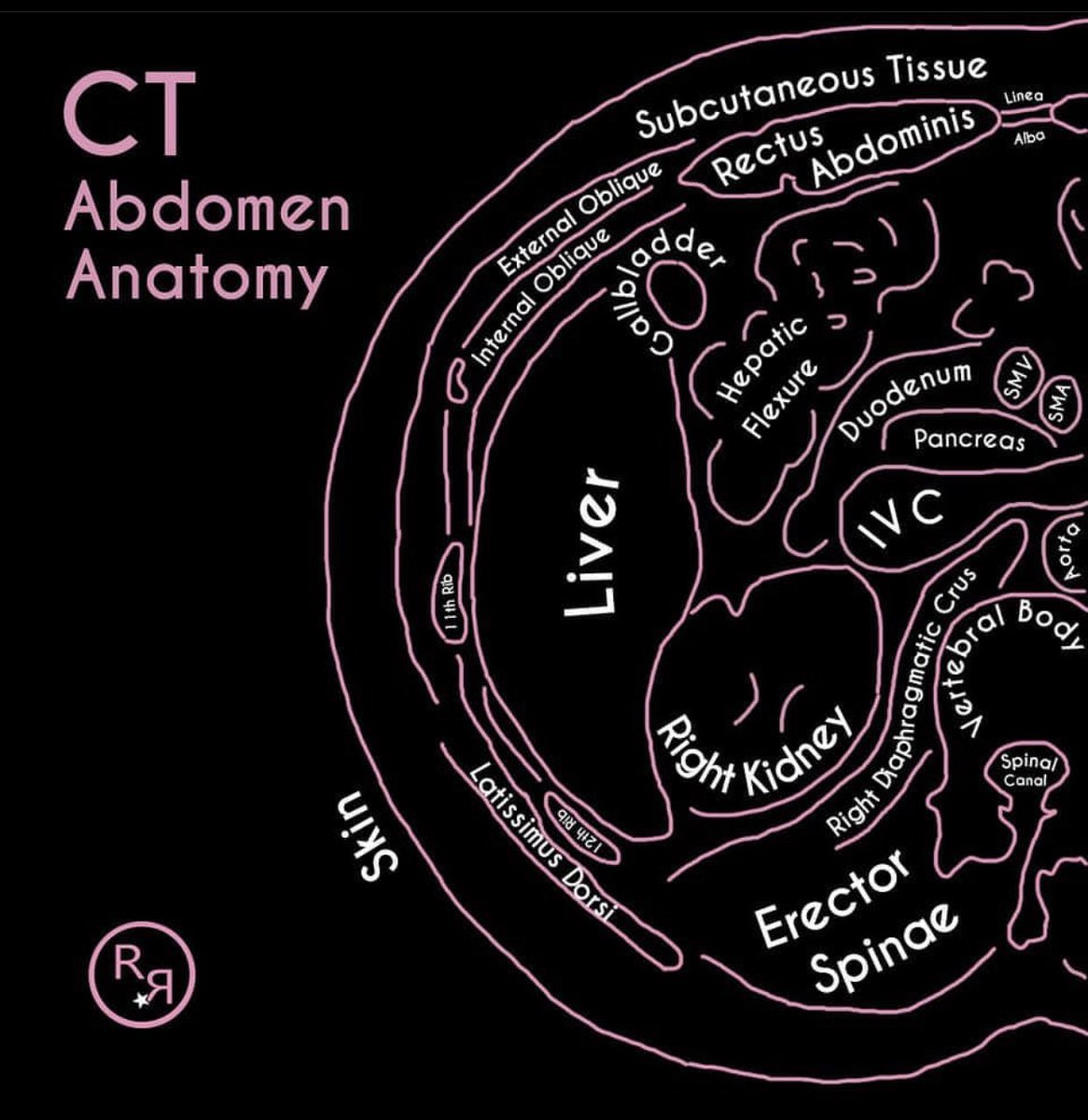 Medical_MD1's tweet photo. CT Abdomen Anatomy ✨

How to distinguish the features in an abdominal CT, very useful 😍👌🏼

- https://t.co/8Y5IVdXMC0