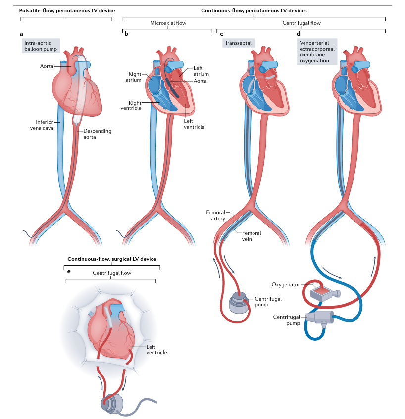 Critical Care Reviews (@critcarereviews) on Twitter photo Great review on temporary mechanical circulatory support devices from <a href="/NatRevCardiol/">Nature Reviews Cardiology</a>
➡️ Types
➡️ Indications
➡️ Complications
➡️ Physiology
➡️ Future
One of many excellent open access review articles in this week's newsletter
criticalcarereviews.com/newsletters/cu… Great review on temporary mechanical circulatory support devices from <a href="/NatRevCardiol/">Nature Reviews Cardiology</a>
➡️ Types
➡️ Indications
➡️ Complications
➡️ Physiology
➡️ Future
One of many excellent open access review articles in this week's newsletter
criticalcarereviews.com/newsletters/cu…