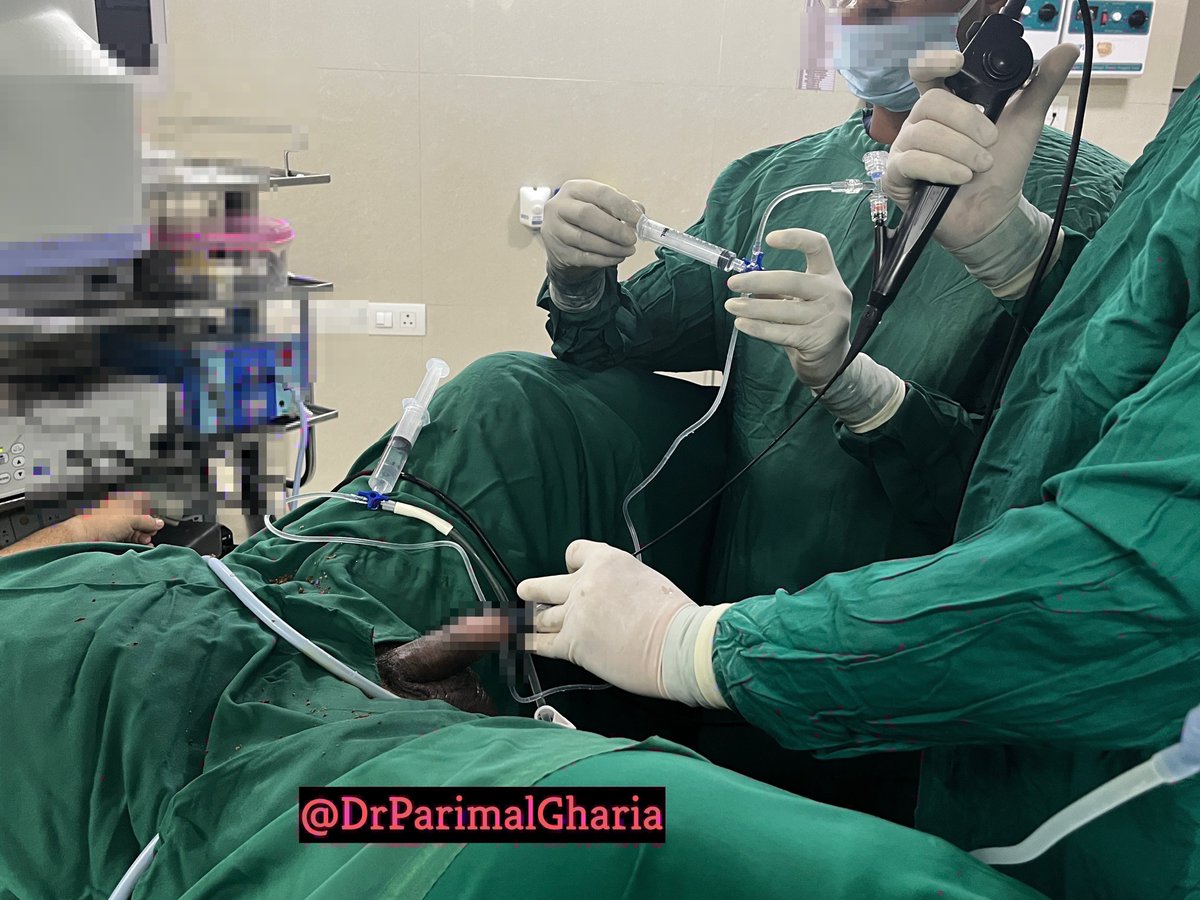 #Suction in #RIRS.
Simple , 
Sterile, 
Cost effective
Easily available
1 litre Normal Saline
Standard TUR set
10 cc &amp; 20 cc syringe
3 way with 10 cm &amp; 100-150 cm extension
@GoumasUrologia <a href="/lkeshav1965/">Keshavamurthy R</a> <a href="/Mohamedendourol/">Mohamed_omar</a> <a href="/Urologeman/">Urologeman (Nariman Gadzhiev)</a> <a href="/sbinhamrii/">Saeed Bin Hamri</a> <a href="/MohsinUrologist/">Dr Mohsin Quadri 🇮🇳</a>