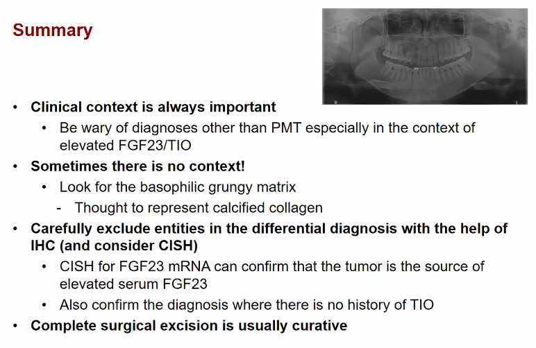 UChicagoPath's tweet photo. #IRAP22 Case 6 presented by PGY1 @ChandniDesai20
Middle aged male with right maxillary mass
Final dx: Phosphaturic mesenchymal tumor https://t.co/vkhLP1k9xC