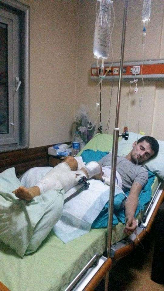 KeremAlpaslan13's tweet photo. Sadece hayata tutunmak için iş istiyorum @1_Muslera_25 @ATV @cbsbb @tcbestepe @trthaber @engelsizbestepe @ashb_eyhgm @aspor @Selcuk @haluklevent @TurkiyeIsKurumu 28 yaşındayım lise mezunuyum yirmi ameliyat oldum sol bacağım diz altı protez Artvinliyim 05347424809 https://t.co/kF1KiTeXV1