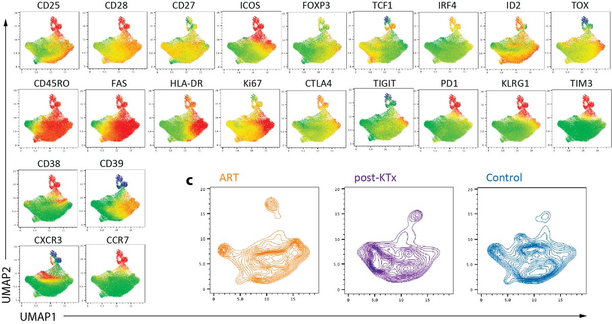 Tang Lab (@tang_lab_ucsf) on Twitter photo Would Treg cell therapy promote immune tolerance to transplanted organs in humans? We launched the ARTEMIS study with <a href="/SandyFeng8/">SandyFeng</a> <a href="/UCSFTransplant/">UCSF Transplant</a> to find out. Our findings have just been published in <a href="/ScienceTM/">Science Translational Medicine</a>. scim.ag/t0 Would Treg cell therapy promote immune tolerance to transplanted organs in humans? We launched the ARTEMIS study with <a href="/SandyFeng8/">SandyFeng</a> <a href="/UCSFTransplant/">UCSF Transplant</a> to find out. Our findings have just been published in <a href="/ScienceTM/">Science Translational Medicine</a>. scim.ag/t0