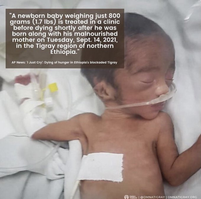 Humaness2020's tweet photo. There must be justice and accountability for the 
#2YearsOfTigrayGenocide!

♦️600K+ civilian died
♦️120K women &amp; girls raped
♦️6.3 M in need of urgent food assistance 
♦️2.5 M displaced
♦️90% Health care systems destroyed
♦️80% Schools looted &amp; destroyed https://t.co/qr5nyjGjIs
