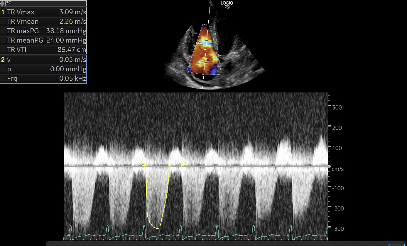 Ahmed T Abdellah on Twitter: 