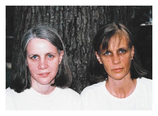 AvrahamCooperMD's tweet photo. These two women are identical twins. One of them had a chronic illness.

1. What is the diagnosis? 
2. Explain your reasoning!

#MedTwitter https://t.co/mBu7qEm3C5