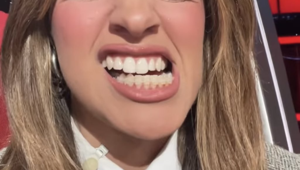 kcedrew's tweet photo. se eu descubro o dentista que fez isso eu denuncio na hora! https://t.co/bb19DHKKnP