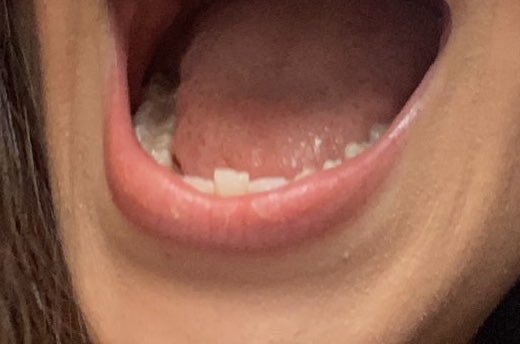 kcedrew's tweet photo. se eu descubro o dentista que fez isso eu denuncio na hora! https://t.co/bb19DHKKnP
