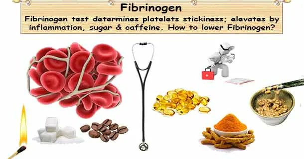 healthyojas's tweet photo. Fibrinogen Test, High Fibrinogen causes, how can you lower Fibrinogen? https://t.co/F7cxFNu3HV #Fibrinogen #Test, #HighFibrinogen #Cholesterol https://t.co/69vt06qiyN
