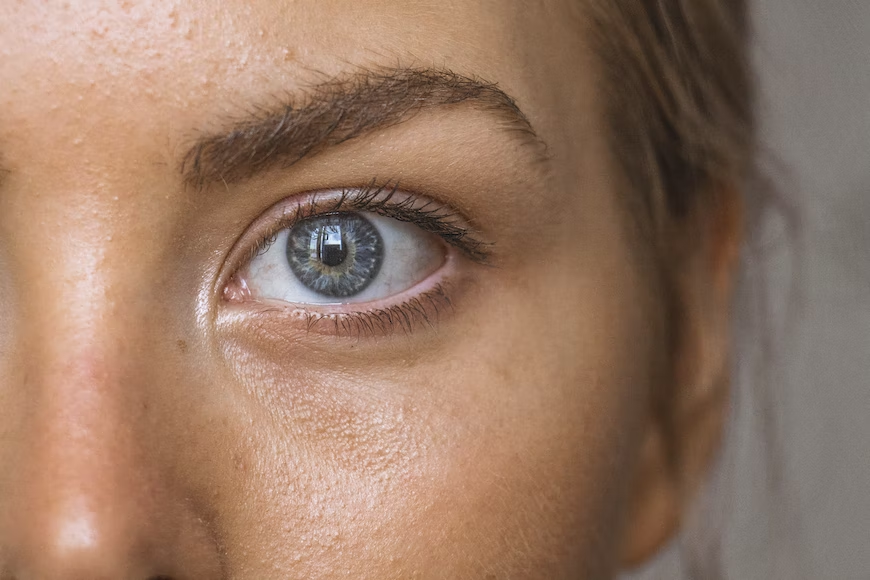 sanclemente01's tweet photo. Acne is one of America’s most common skin problems. All thanks to today’s technology, treating different types of acne is at hand. https://t.co/Dq3WUuUyBA https://t.co/r5OuQbUkA1