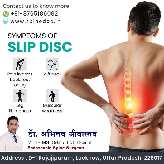 #sleepdisc #slipdisctreatment #LegNumbness #stiffneckandshoulder #muscularweakness #spinesurgery #spinesurgeryrecovery #spineproblem #spine #SpinePosture #poorposture #spondylitis 

DR. ABHINAV SRIVASTAVA
MBBS,MS,FNB
(SPINE SURGEON)
CONTACT NO. :8765186092