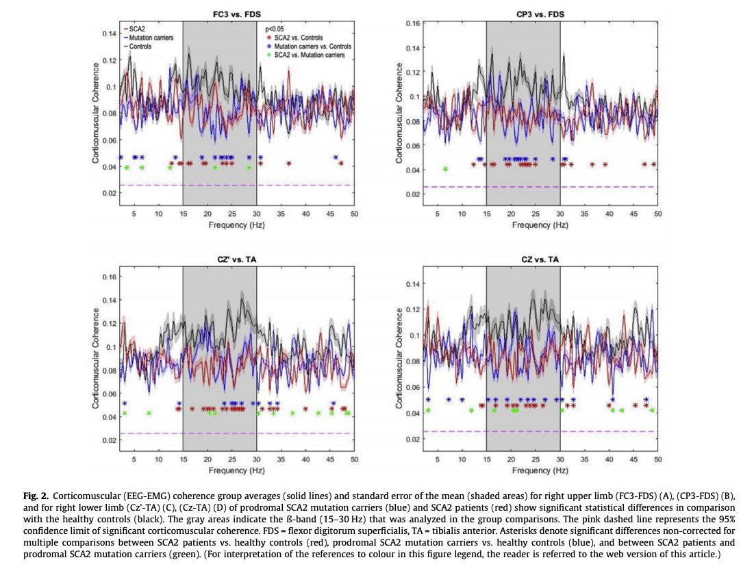 ClinicalNeuroph's tweet photo. [EEG-EMG study] Velázquez-Pérez et al.: “EEG-EMG and EMG-EMG coherence may serve as biomarkers of early corticospinal tract neurodegeneration in prodromal SCA2 mutation carriers.”

https://t.co/cXPj8sVoFn
#EEG #EMG #SCA2 #iccn2022 https://t.co/W2eJbY7d8k