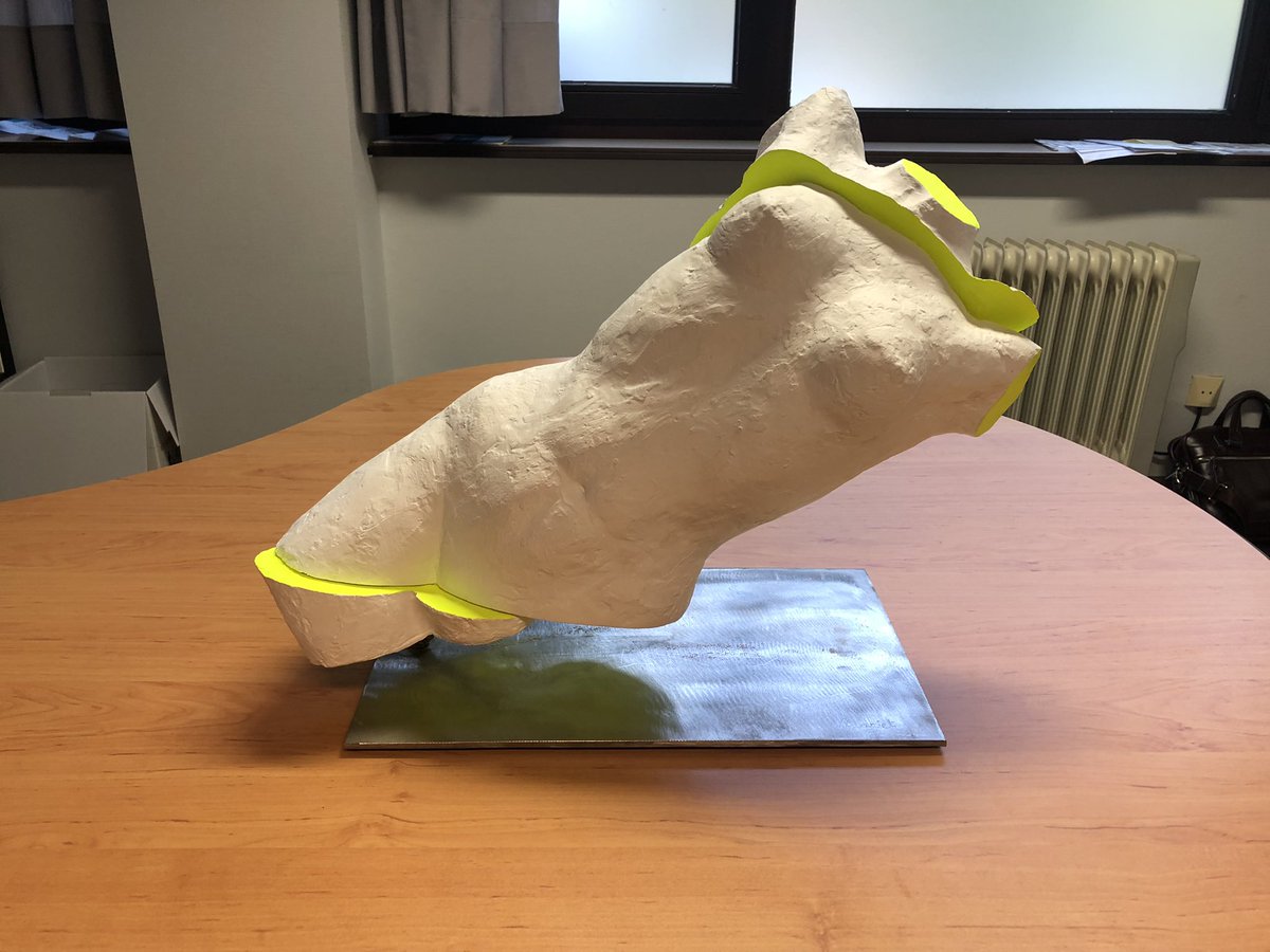 Very thankful to get a homemade ‘piece of art’ from a for rectal cancer treated patient. She explained that insecureness about her future was fixed and wth more strength than before! Honored! <a href="/ZOLziekenhuis/">ZOL</a> <a href="/futurehealthzol/">Future Health by ZOL Genk</a> <a href="/MargaBogaert/">Marga Bogaert</a> <a href="/kobrastreetart/">Eduardo Kobra / kobrastreetart</a> <a href="/uhasselt/">Universiteit Hasselt</a> <a href="/BenBenCreatures/">BenPeeters</a>