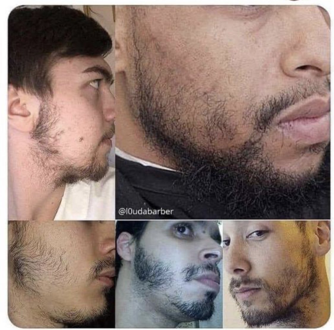 Cryptol95513563's tweet photo. I dont know who needs to hear this but THIS IS NOT A BEARD ❌ https://t.co/KkYBx3wcKf