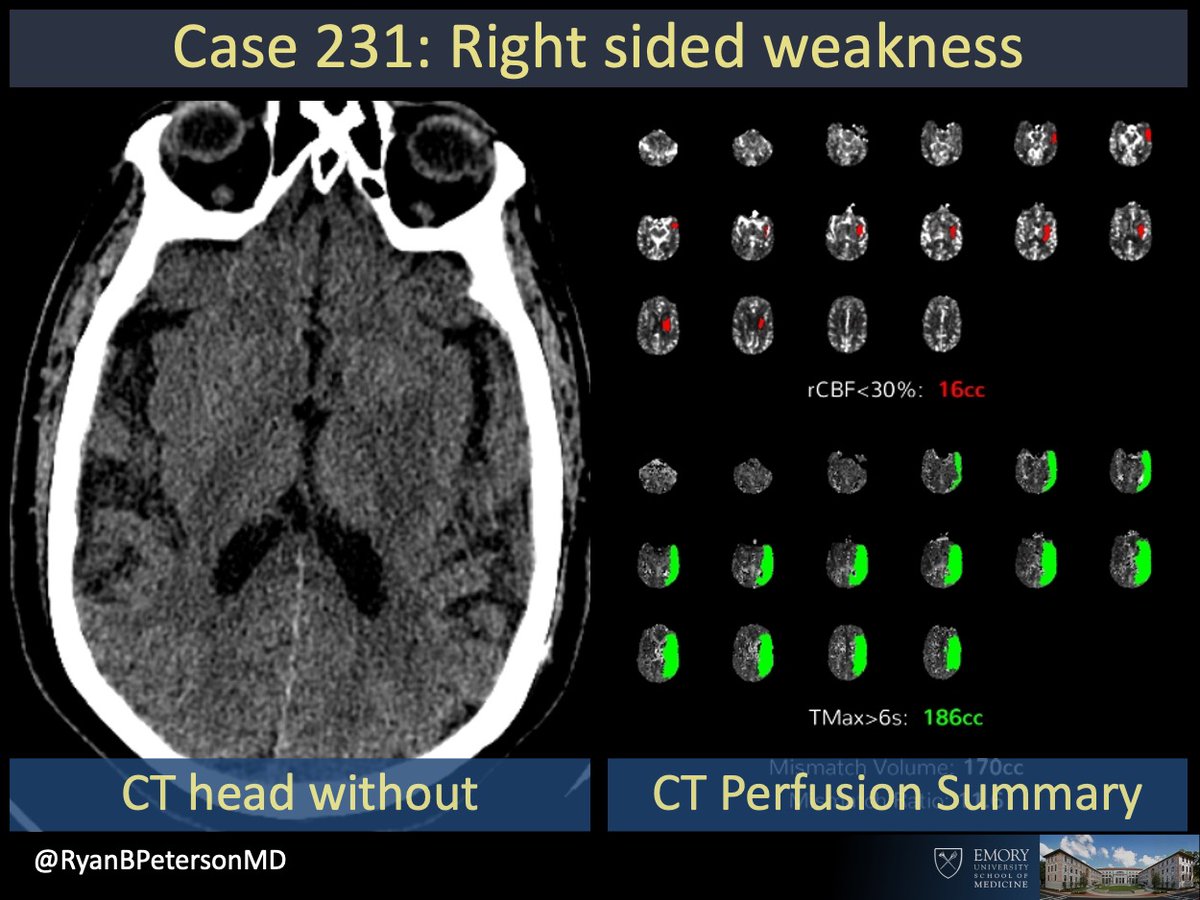 Ryan B Peterson 🇸🇪 tweet media