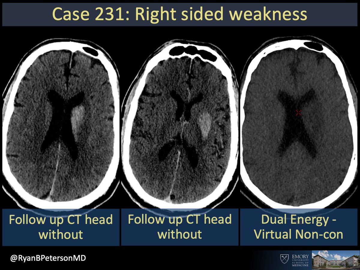 Ryan B Peterson 🇸🇪 tweet media