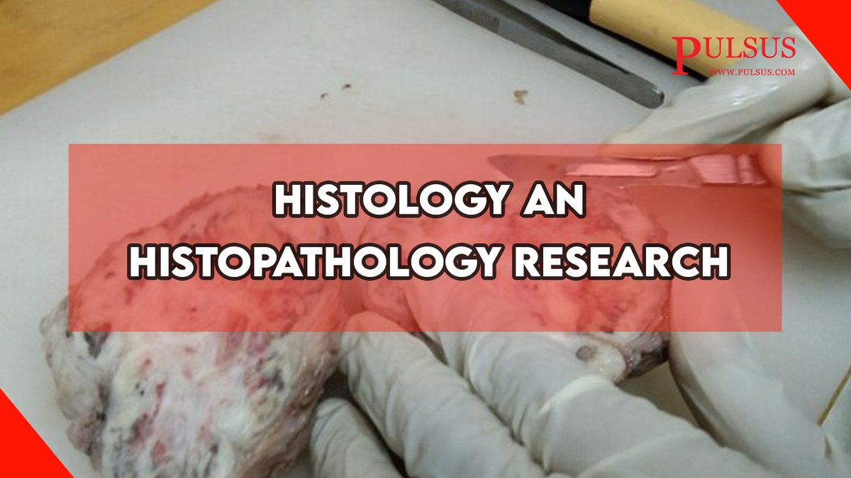Welcome to our Open Access Journal
Histology and Histopathology Research
ext-6207591.livejournal.com/867.html