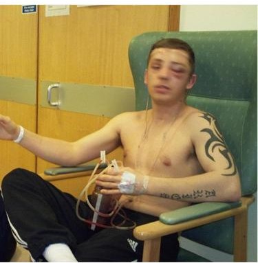 Whowaa's tweet image. One night my life changed. 

I was involved in a RTA

I was given a 4% chance to live

After multiple resuscitations

The Dr saved my life

And then proceeded to neglected me (botched operations) check bio 👀

For years I&apos;ve been miss treated and told to take these pills.