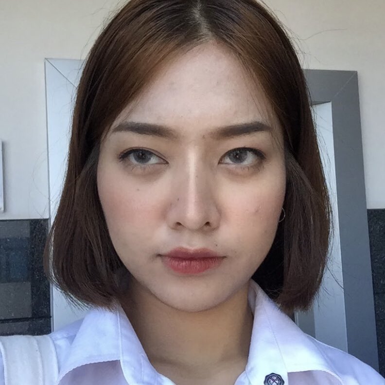 mildnitha's tweet photo. ศัลยกรรมจมูกครั้งแรกในชีวิต vs ครั้งที่4 แบบมีประสบการณ์แล้ว ความต่างคือครั้งแรกไปทำแบบไม่ได้หารีวิวหรือหาข้อมูลเรื่องการทำจมูกแล้วก็ไม่รู้ว่าต้องบอกหมอยังไง รอบล่าสุดคือหาข้อมูลแน่น เรฟแน่น คุยกับหมอจนเข้าใจตรงกัน 5555555555 รอบนี้ถือว่าปังเลย เข้ากับหน้าสุด https://t.co/73ZD19NoIw