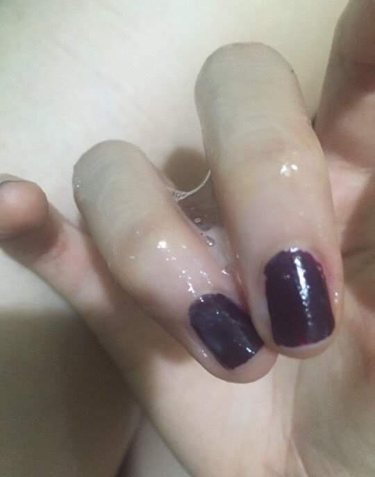 लास्टै! तरल पदार्थ बगेर आपत भो गाइच , केही निको पार्ने उपाय छ कि 🤔🤔😭😭