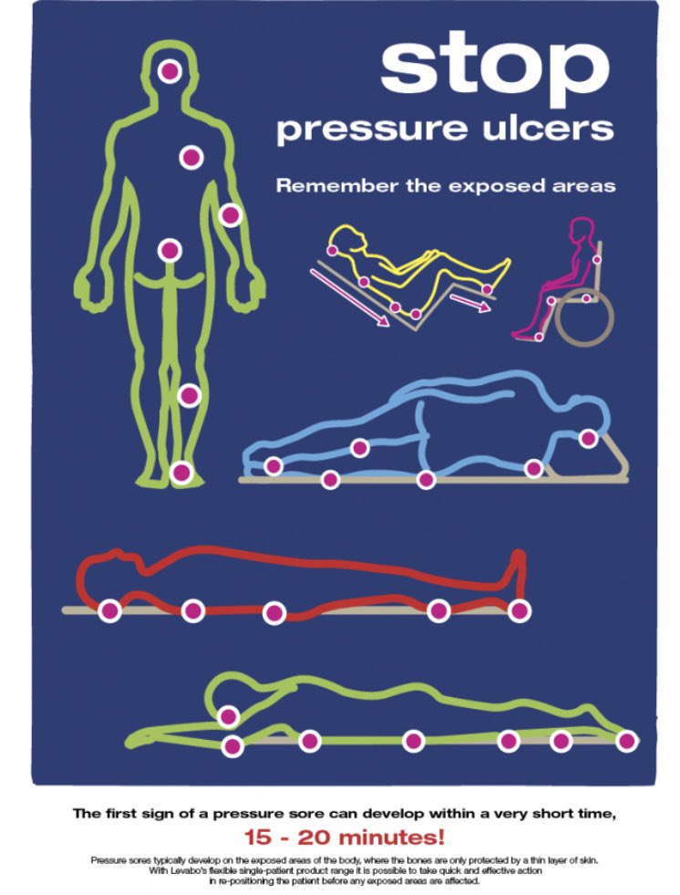 Just 2 days to go for 2022 STOP PRESSURE DAY. Keep an eye out for us around the Health Board and come and have a chat to your Tissue Viability Nurses