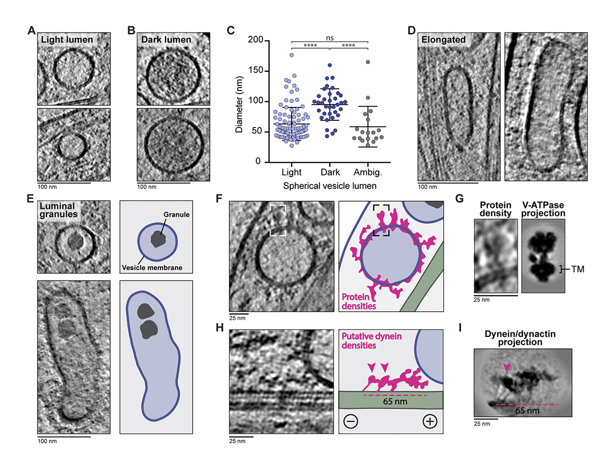 A cryo-ET survey of #microtubules and intracellular compartments in mammalian axons, from <a href="/_Helen_Foster_/">Helen Foster</a>, @CamillaVenturaS <a href="/Carter_Lab/">Carter Lab</a>: bit.ly/3pAxO8U

From our Cellular Neurobiology 2022: bit.ly/3NQFD5Y #SfN22