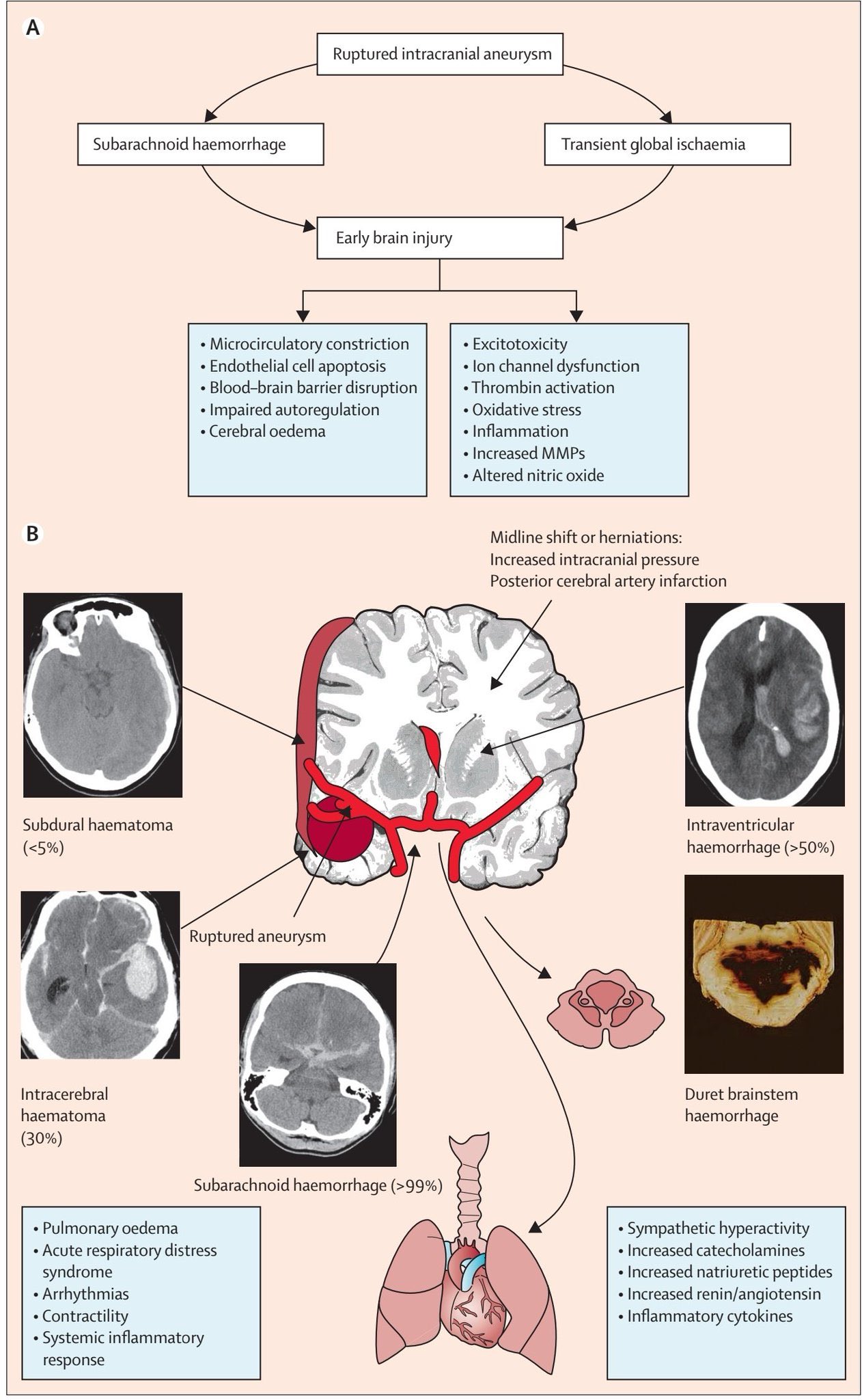 Oren Gottfried, MD on Twitter: 